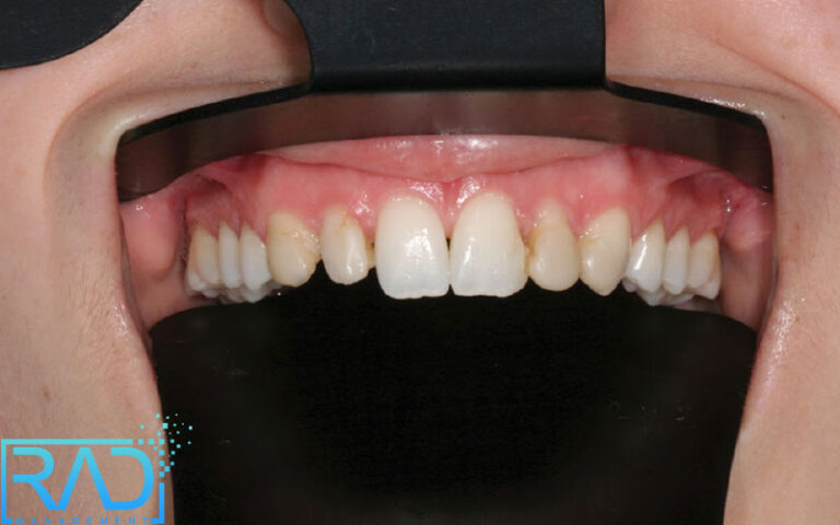 صفر تا صد پروژه های عکاسی دندانپزشکی